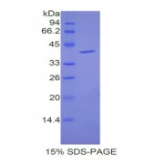 SDS-PAGE analysis of Mouse Cholecystokinin Protein.
