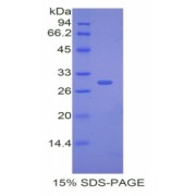 SDS-PAGE analysis of Rabbit CETP Protein.