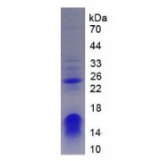 SDS-PAGE analysis of Human CHD3 Protein.