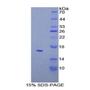 SDS-PAGE analysis of Human CD160 Protein.