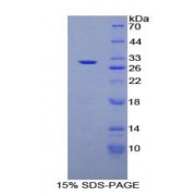SDS-PAGE analysis of Human CD1d Protein.