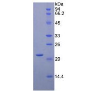 SDS-PAGE analysis of Human CD8b Protein.