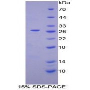 SDS-PAGE analysis of Human Coagulation Factor XII Protein.
