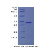 SDS-PAGE analysis of recombinant Human COL4A1 Protein.