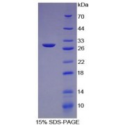 SDS-PAGE analysis of recombinant Human Collagen Type IV Alpha 2 Protein.