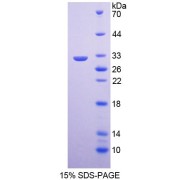 SDS-PAGE analysis of Human COL4a5 Protein.