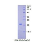 SDS-PAGE analysis of Human COL8A1 Protein.