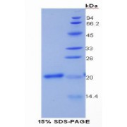 SDS-PAGE analysis of Human Collagen Type XV Protein.