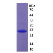 SDS-PAGE analysis of Human Collagen Type XVIII Protein.