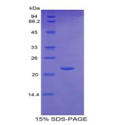 SDS-PAGE analysis of Mouse GCSFR Protein.