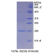 SDS-PAGE analysis of Rat MCFSR Protein.