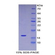 SDS-PAGE analysis of Mouse Complement 1 Inhibitor Protein.