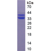 SDS-PAGE analysis of recombinant Rat C3a Protein.