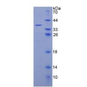 SDS-PAGE analysis of recombinant Human C3a Protein.