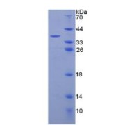 SDS-PAGE analysis of recombinant Human C3a Protein.