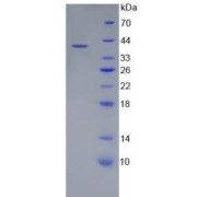 SDS-PAGE analysis of recombinant Rat Complement Component 5a (C5a) Protein.