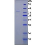 SDS-PAGE analysis of Rat C5a Protein.
