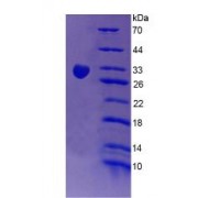 SDS-PAGE analysis of recombinant Human CR1 Protein.