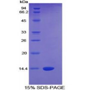SDS-PAGE analysis of Human CTGF Protein.
