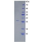 SDS-PAGE analysis of recombinant Human CORIN Protein.