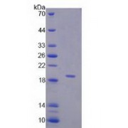 SDS-PAGE analysis of recombinant Human Corticosteroid Binding Globulin (CBG) Protein.
