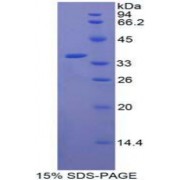 SDS-PAGE analysis of recombinant Human CRAF Protein.