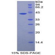 SDS-PAGE analysis of Human CKM Protein.