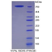 SDS-PAGE analysis of Pig CKM Protein.