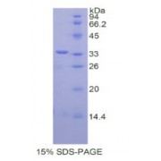 SDS-PAGE analysis of Human CREB Binding Protein.
