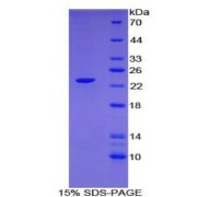 SDS-PAGE analysis of Human CLEC10A Protein.