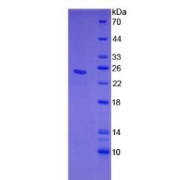 SDS-PAGE analysis of Human CLEC4C Protein.