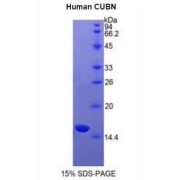 SDS-PAGE analysis of recombinant Human Cubilin Protein.