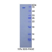 SDS-PAGE analysis of Human Cyclin D1 Protein.