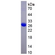 SDS-PAGE analysis of recombinant Human CDK5 Protein.