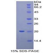 SDS-PAGE analysis of Human Cyclophilin B Protein.