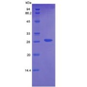 SDS-PAGE analysis of recombinant Mouse CTH Protein.