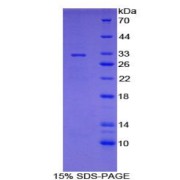SDS-PAGE analysis of Mouse CYP7A1 Protein.