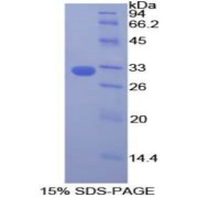 SDS-PAGE analysis of Human DOCK1 Protein.