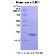 SDS-PAGE analysis of Human delta Like 1 Homolog Protein.
