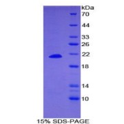 SDS-PAGE analysis of Human Dermatopontin Protein.