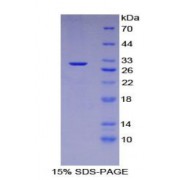 SDS-PAGE analysis of Human Desmin Protein.