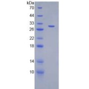 SDS-PAGE analysis of Mouse DGKa Protein.