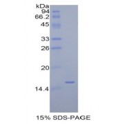 SDS-PAGE analysis of Human Diamine Oxidase Protein.