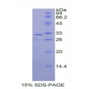 SDS-PAGE analysis of Human DKK1 Protein.