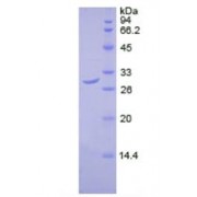 SDS-PAGE analysis of recombinant Human DLAT Protein.