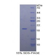 SDS-PAGE analysis of Human DVL1 Protein.