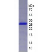 SDS-PAGE analysis of recombinant Human DVL2 Protein.