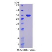 SDS-PAGE analysis of recombinant Human DNMT1 Protein.