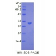 SDS-PAGE analysis of Mouse Dystrophin Protein.