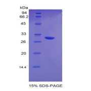 SDS-PAGE analysis of recombinant Mouse EGR2 Protein.